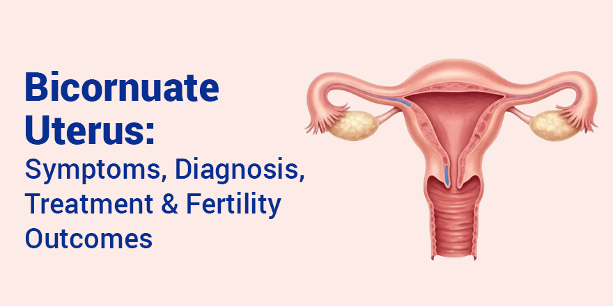 Bicornuate Uterus: Symptoms, Diagnosis, Treatment & Fertility Outcomes